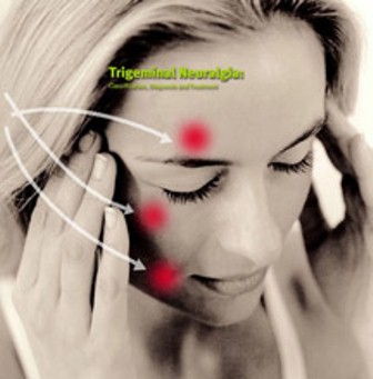 Trigeminal Nevraljinin tedavisi